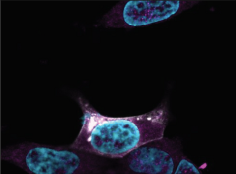Confocal fluorescence microscopy image of a microprotein in human cells,