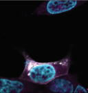 Confocal fluorescence microscopy image of a microprotein in human cells,